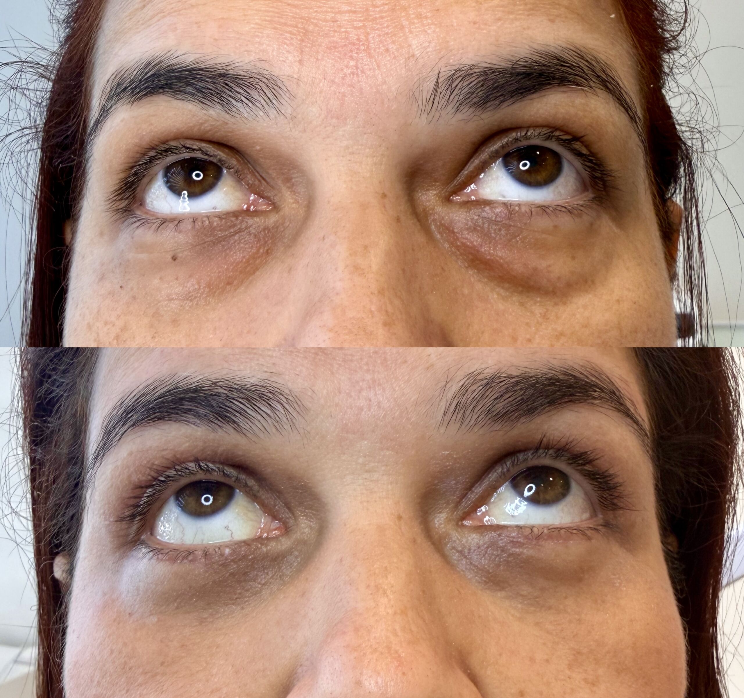 Cirugia Dermatologica